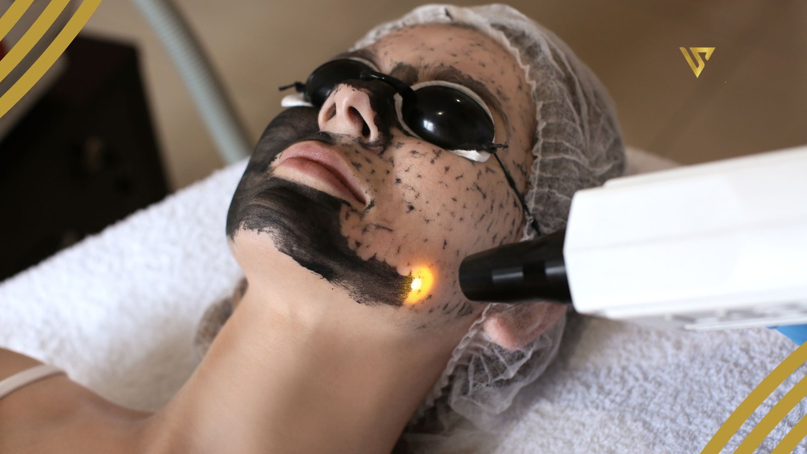 Person gets a hollywood laser peel done with a professional team  beauty spa by Val