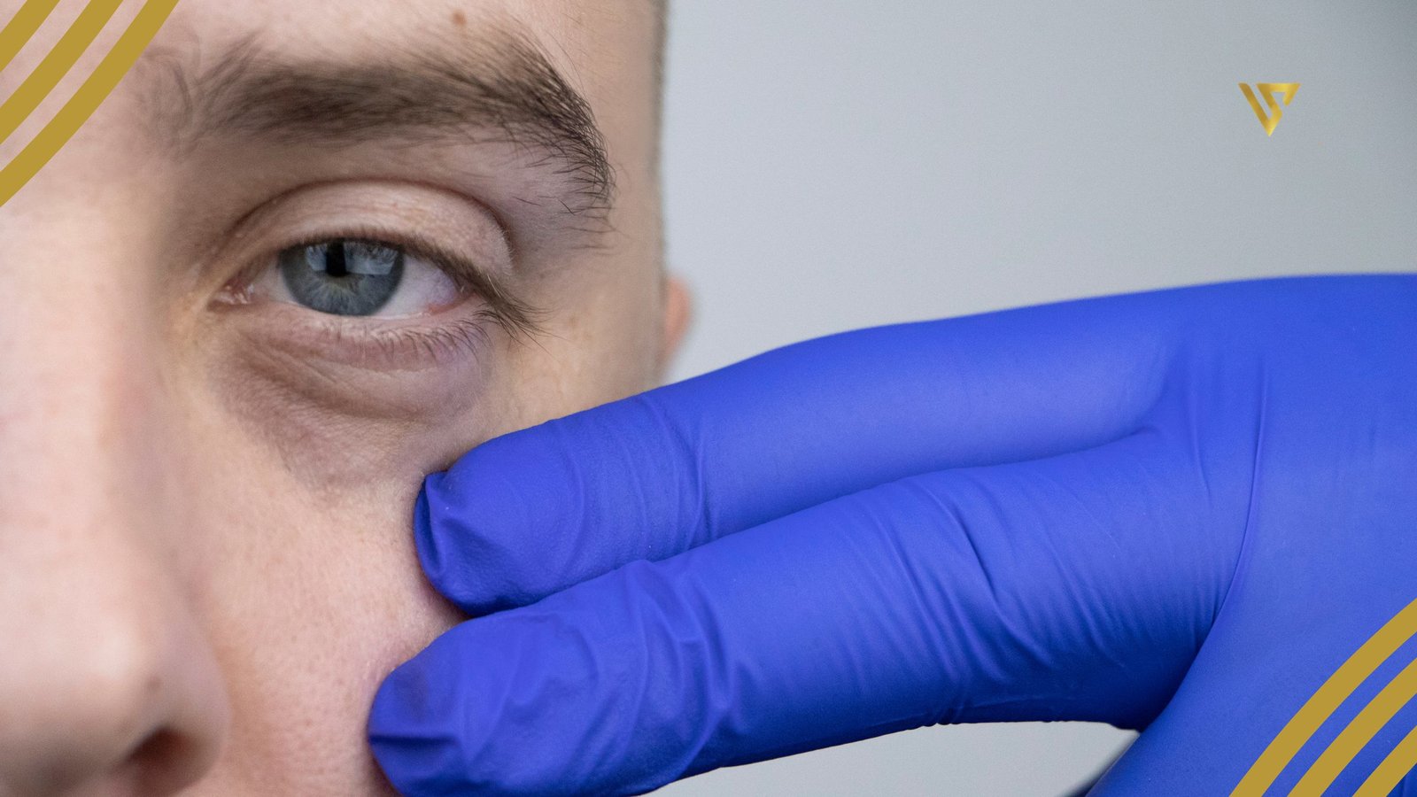 Two gloved fingers under the eye of a person with dark circles remove dark circles beauty spa by val