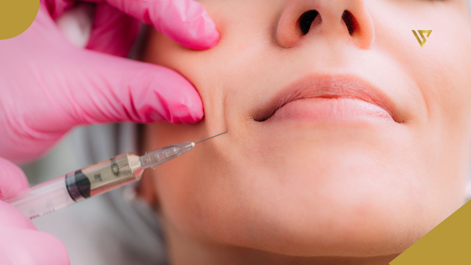 Close-up of a woman’s face, left hand wearing a pink glove holding the skin of the right cheek, right hand wearing a pink glove holding a syringe with a needle placed on the nasolabial fold. PRP: Your Body's Own Power to Smooth Smile Lines. Beauty Spa by Val. 