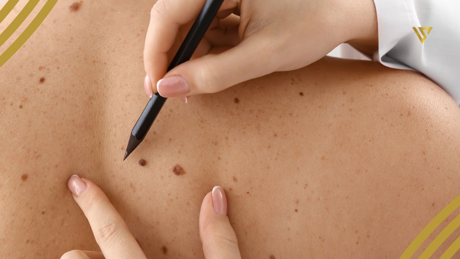 The Best Treatments for Body Skin Health in 2025: Expert Insights