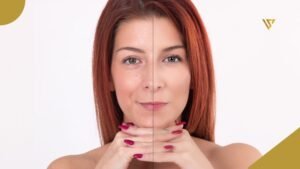 Young red-haired woman looking forward with her face divided into two halves to show a before-and-after facial treatment result, hands resting under her chin, against a minimalist white background. Nasolabial Fold Treatment: What Are Your Options Without Surgery? Beauty Spa by Val